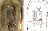 Sorpresa para antropólogos: Hallan en Italia un ‘cíborg’ medieval con un cuchillo en vez de mano