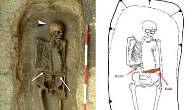Sorpresa para antropólogos: Hallan en Italia un ‘cíborg’ medieval con un cuchillo en vez de mano