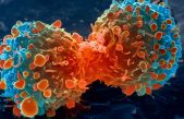En el inicio del cáncer: una lupa para investigar el Big Bang tumoral