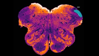 Dicen que han descubierto una nueva región del cerebro