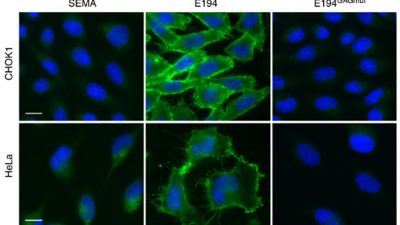 Descubierta una nueva estrategia utilizada por los virus para evadir el sistema inmune