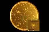 Posible conexión de una bacteria intestinal con la depresión