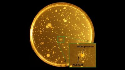 Posible conexión de una bacteria intestinal con la depresión