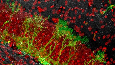 La agresión genera nuevas neuronas en el cerebro
