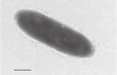 Estas bacterias se alimentan de hidrocarburos y vive en el lugar más profundo de la Tierra