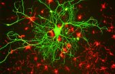 La actividad física prepara a las neuronas para regenerarse en caso de lesión medular