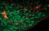 Descubren la zona del cerebro que nos enseña a aprender del dolor
