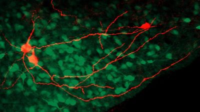 Descubren la zona del cerebro que nos enseña a aprender del dolor