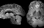Nunca hemos visto un cerebro tan completo como este tras 100 horas de resonancia magnética
