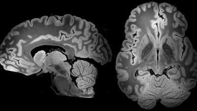 Nunca hemos visto un cerebro tan completo como este tras 100 horas de resonancia magnética
