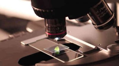 Descubierto un nuevo mecanismo que podría mejorar las lesiones medulares