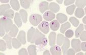 Una vacuna podría favorecer la adquisición de inmunidad natural contra la malaria