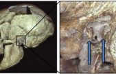 El oído de surfista era común entre los neandertales