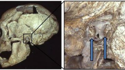 El oído de surfista era común entre los neandertales