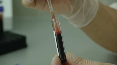 Científicos chinos modifican células sanguíneas para bloquear el VIH sin efectos secundarios