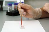 Descubren una molécula capaz de destruir las células cancerígenas e impedir su recurrencia