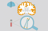 El envejecimiento celular provoca cambios en el cerebro