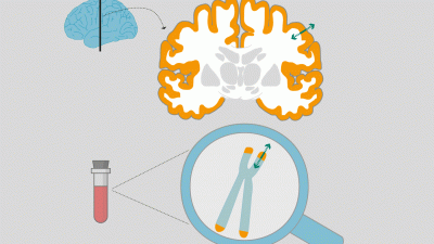 El envejecimiento celular provoca cambios en el cerebro