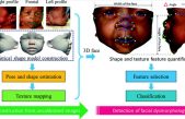 Un método de análisis facial detecta síndromes genéticos con alta precisión