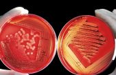 Alianza letal: dos cepas de bacterias ‘comecarne’ se combinan para causar una infección mortal