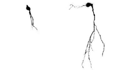El ejercicio físico y los estímulos cognitivos podrían enlentecer el envejecimiento cerebral