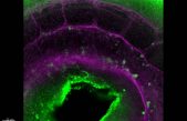 Nuevo paso en la creación de células madre de la sangre en el laboratorio