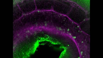 Nuevo paso en la creación de células madre de la sangre en el laboratorio