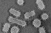 Descubierto el mecanismo que hace que el virus de la gripe se multiplique de forma eficiente