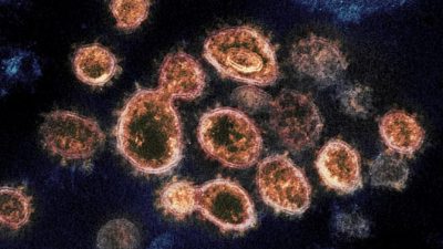 Buscando rasgos genéticos que hacen a alguna gente joven más vulnerable al coronavirus