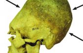 Los llamativos cráneos deformados de un cementerio de más de mil años