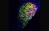 Descubren el interruptor cerebral del dolor