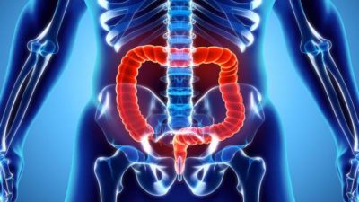 Una investigación intestinal profundiza en los problemas de obesidad