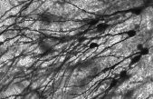 Se descubre una forma de regeneración excepcionalmente rápida en las neuronas lesionadas