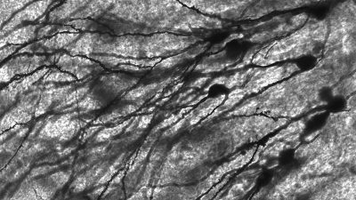 Se descubre una forma de regeneración excepcionalmente rápida en las neuronas lesionadas