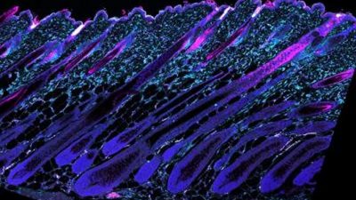 Mecanismo innovador que previene la caída del cabello