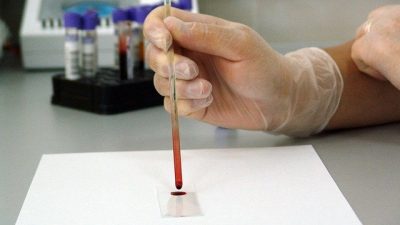 Cómo una gota de sangre puede mostrar si padeces cáncer o no