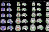 Nuevas técnicas para estudiar la maduración del cerebro fetal