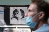 Los científicos de Siberia logran detectar padecimientos pulmonares en menos de un minuto