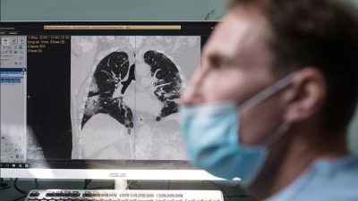 Los científicos de Siberia logran detectar padecimientos pulmonares en menos de un minuto