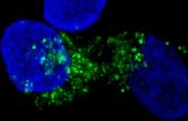 Describen un mecanismo que dificulta la proliferación de las células cancerosas e induce su muerte