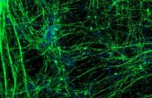 Una molécula lipídica favorecería la generación y recuperación de neuronas tras una lesión cerebral