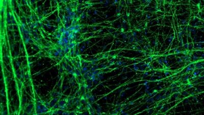 Una molécula lipídica favorecería la generación y recuperación de neuronas tras una lesión cerebral