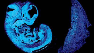 Comunicación entre el feto y la placenta