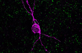 Su viejo cerebro tiene neuronas jóvenes, pero ¿para qué sirven?