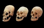 Estos cráneos femeninos fueron deformados de forma artificial