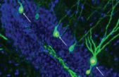 Promover la creación de neuronas para restaurar la memoria en la enfermedad de Alzheimer