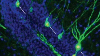 Promover la creación de neuronas para restaurar la memoria en la enfermedad de Alzheimer