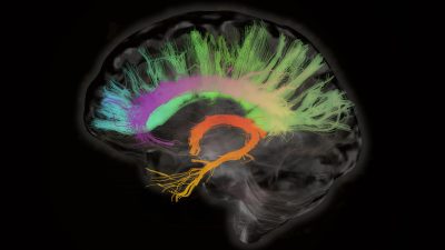 Estimulación cerebral para combatir la pérdida de memoria en la vejez
