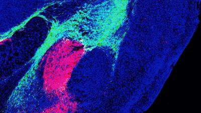 Una sola molécula cerebral decide si sufrimos o disfrutamos