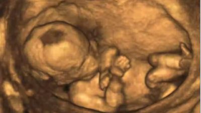 El diagnóstico prenatal, una cuestión de huevos… reptilianos